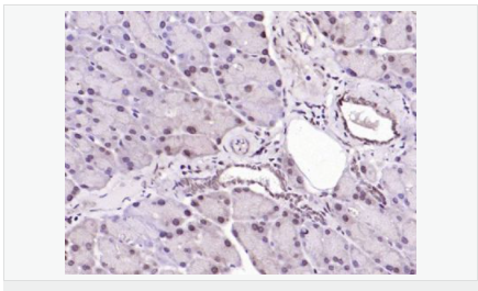 6052bc41261b0.png image.png