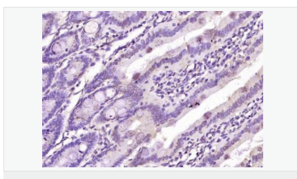 6057fbe8a953f.png image.png