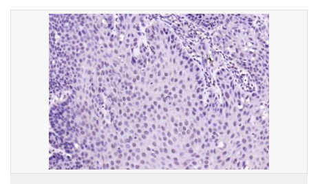 60584c75a1762.png image.png