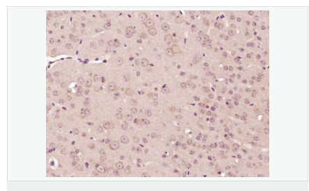 605d899e0460a.png image.png