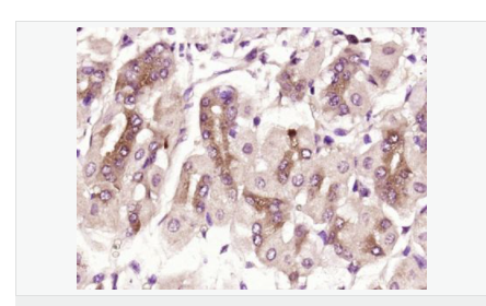 605da053e39f3.png image.png