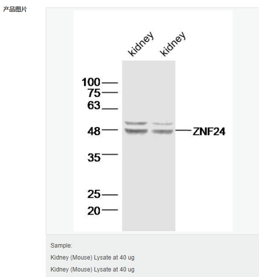 60656ee0107c6.png image.png