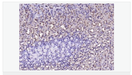 6066d49810bcd.png image.png