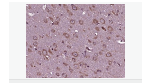 606bc73f981af.png image.png