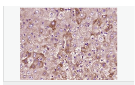 60764971743e2.png image.png